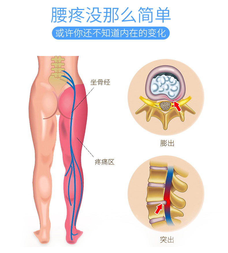 腰疼没那么简单